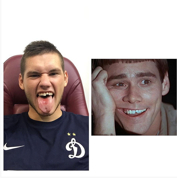 Маурисио извинился перед Ташаевым за сломанный зуб