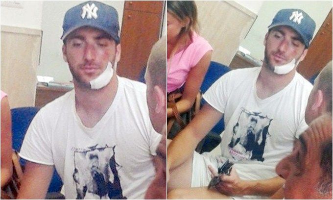 Травма Игуаина может обойтись о. Капри в 100 млн евро