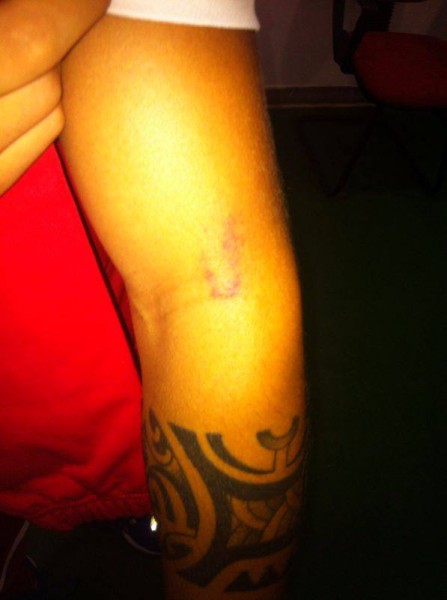 В Италии появился свой Луис Суарес