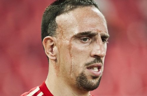 Рибери пропустит матч с \"Арсеналом\"