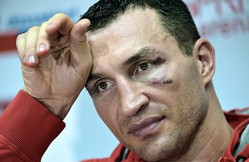 Кличко пообещал провести реванш с Фьюри