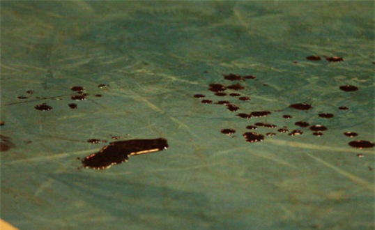 Болельщик травмировал баскетболиста мусорным ведром